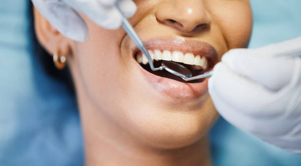 Best Emergency Treatment for Dental Infections or Abscesses in Cut Bank, MT
